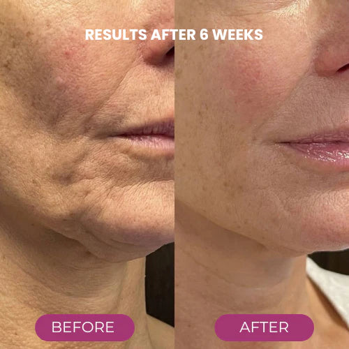 🔥LAST DAY 50% OFF!!✨ Buy More, Save More｜Smooth, Firm & Glow with Petluxecos Multi Balm 💜