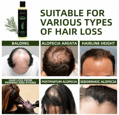 🔥LAST DAY 50% OFF - Petluxecos® Organic Rosemary Hair Growth Shampoo