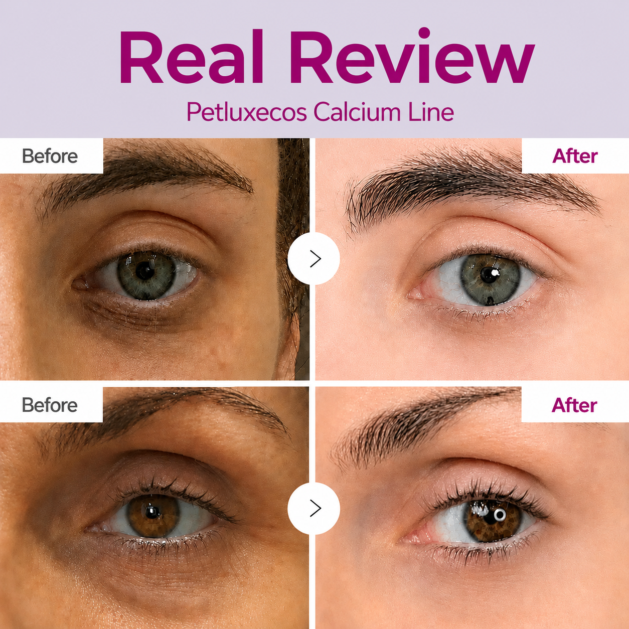 🔥LAST DAY 50% OFF!!Petluxecos Korean Calcium Dark Spot Eye Cream