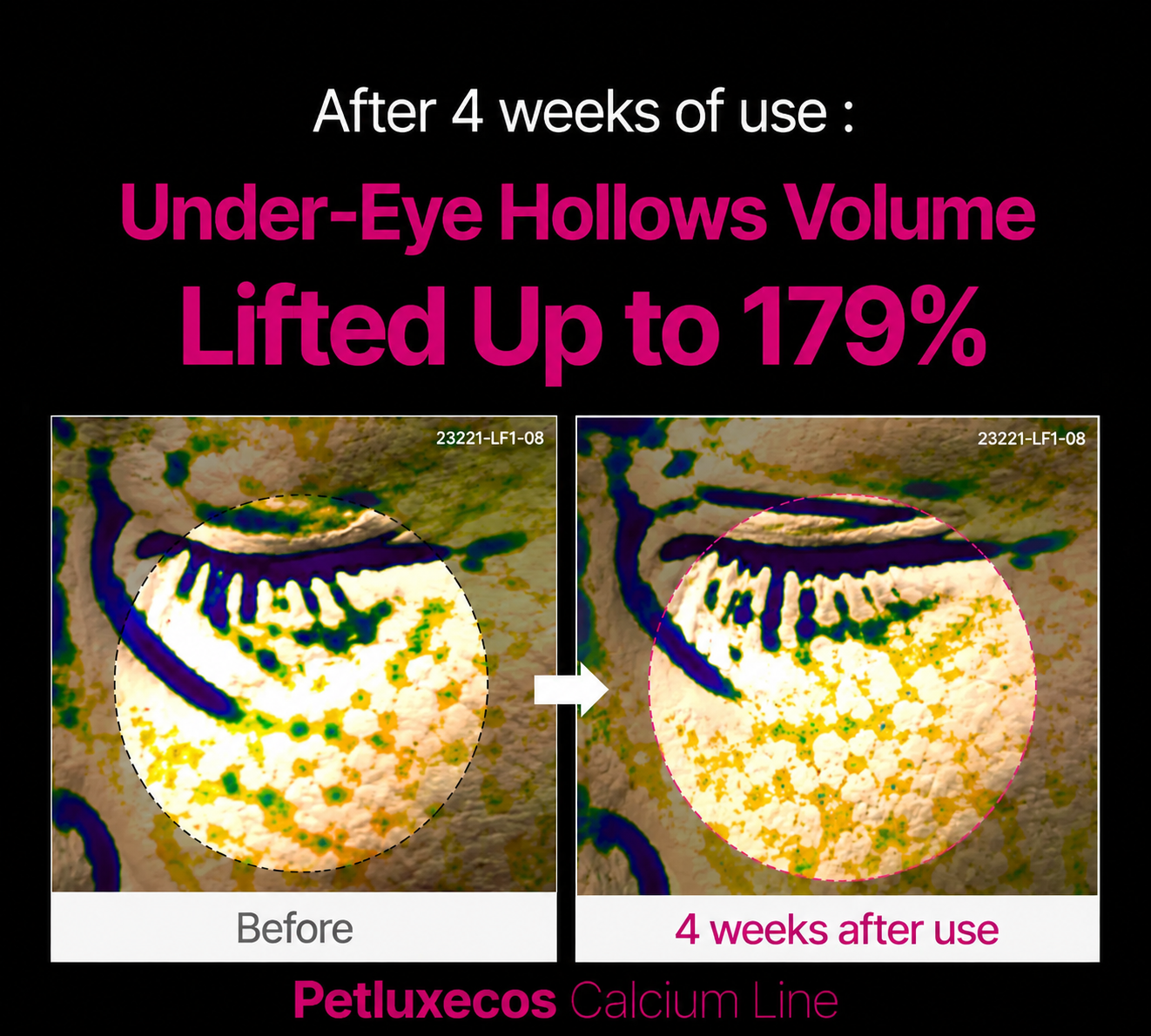 🔥LAST DAY 50% OFF!!Petluxecos Korean Calcium Dark Spot Eye Cream