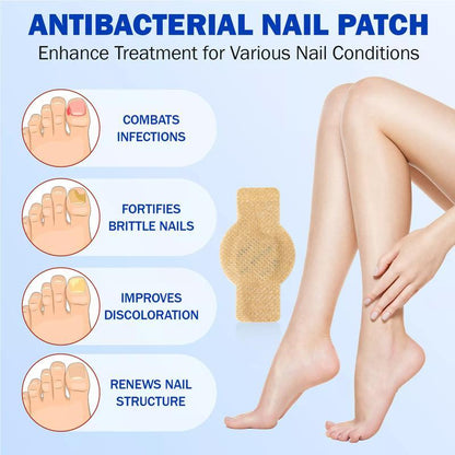 Petluxecos Fungal Nail Repair Patches